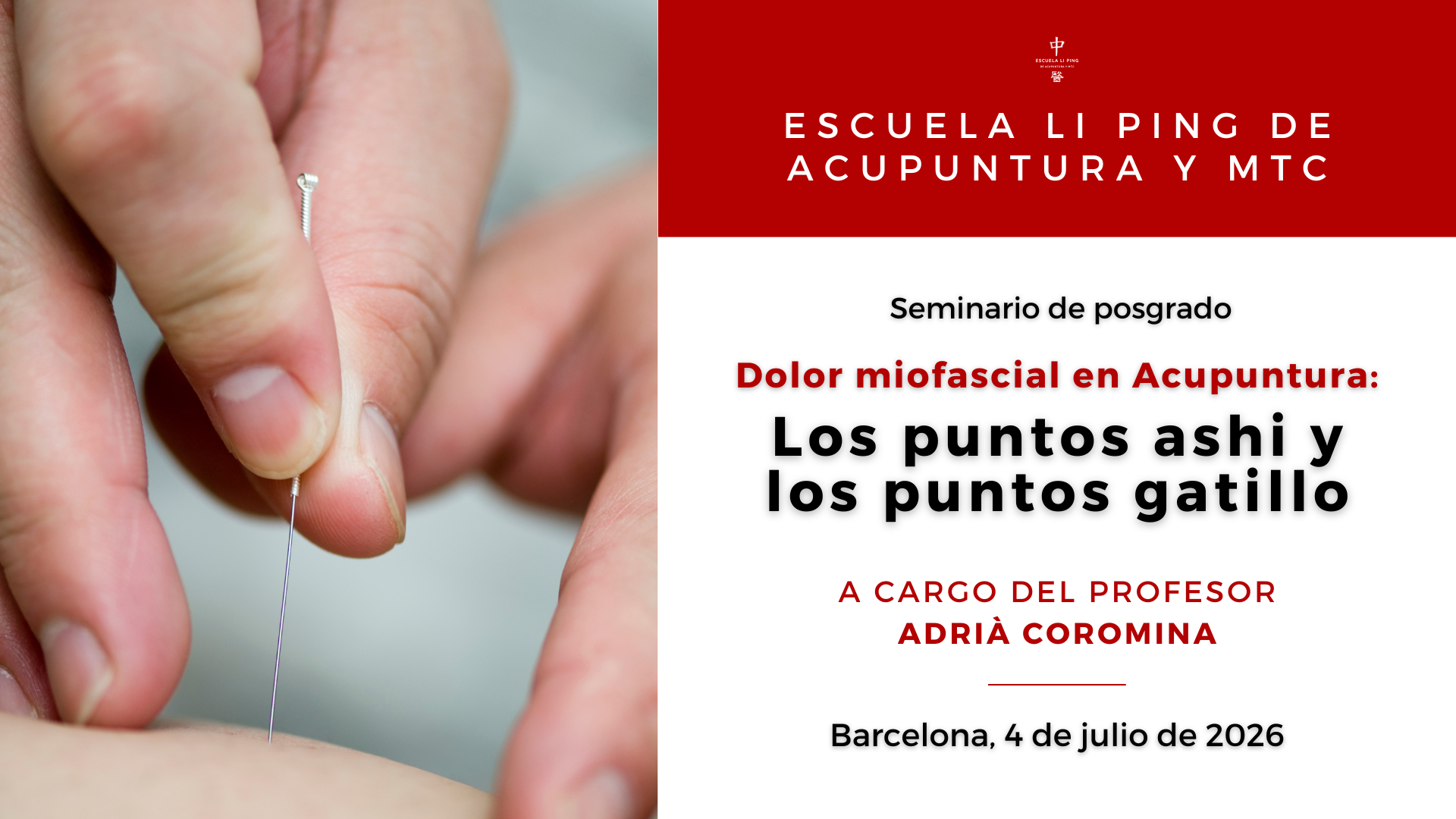 Seminario Puntos ashi y puntos gatillo